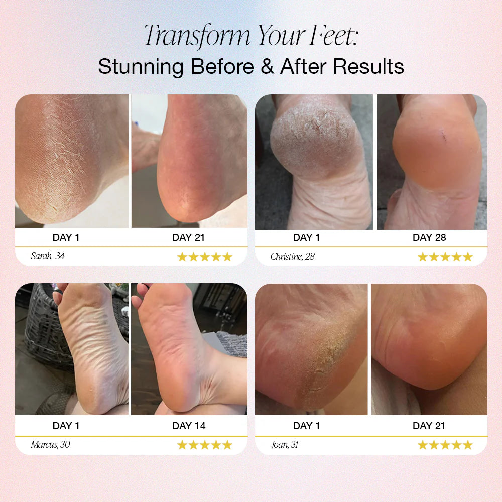 WellioSoft™ | Electric Callus Remover Pro