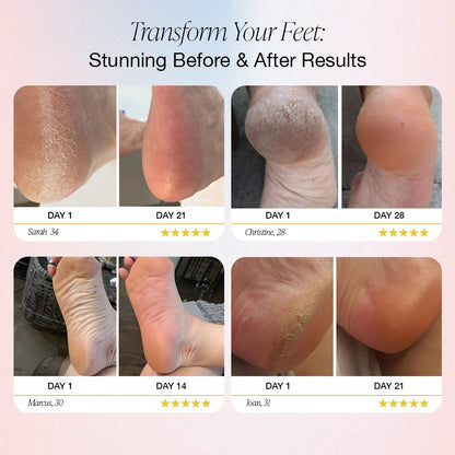 WellioSoft™ | Electric Callus Remover Pro